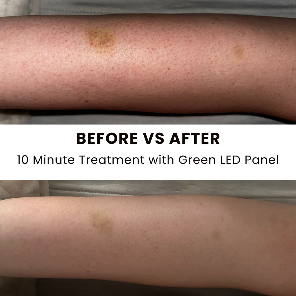 Illuminate Green V1 – Green Light Therapy Panel